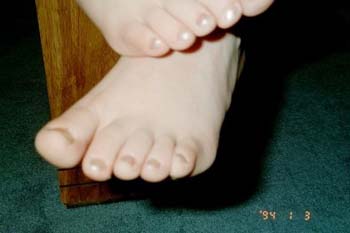 toes